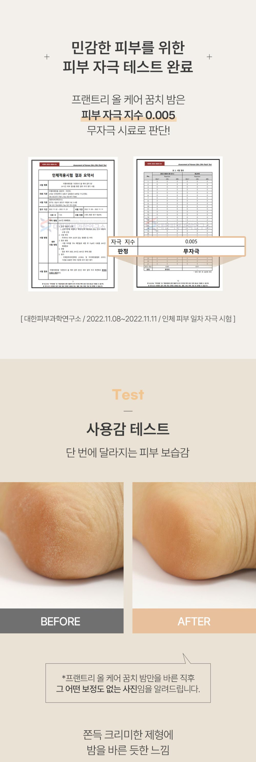 프랜트리 올케어 꿈치밤